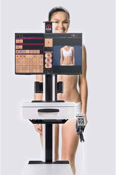 Total Body Mapping mit KI - Moderne Exklusive Hautkrebsvorsorge für Privatpatienten in Frankfurt, Hochtaunus-Kreis, Main-Taunus-Kreis