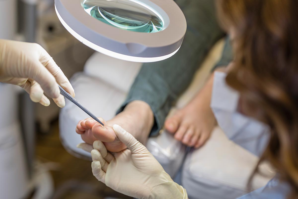 Nagelspange eingewachsener Fußnagel med. Fußpflege Kronberg