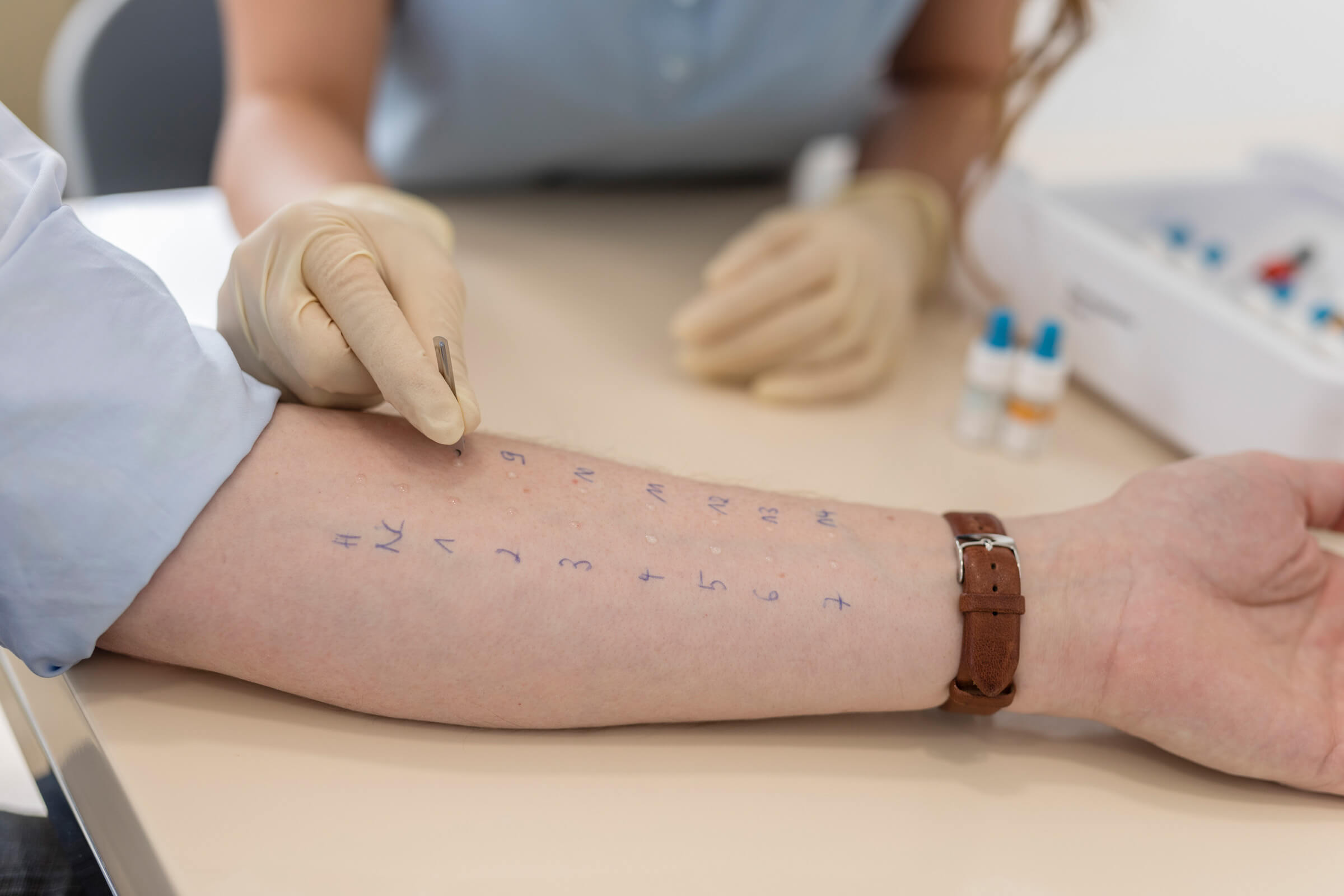 Allergietest Hautarztpraxis Kronberg