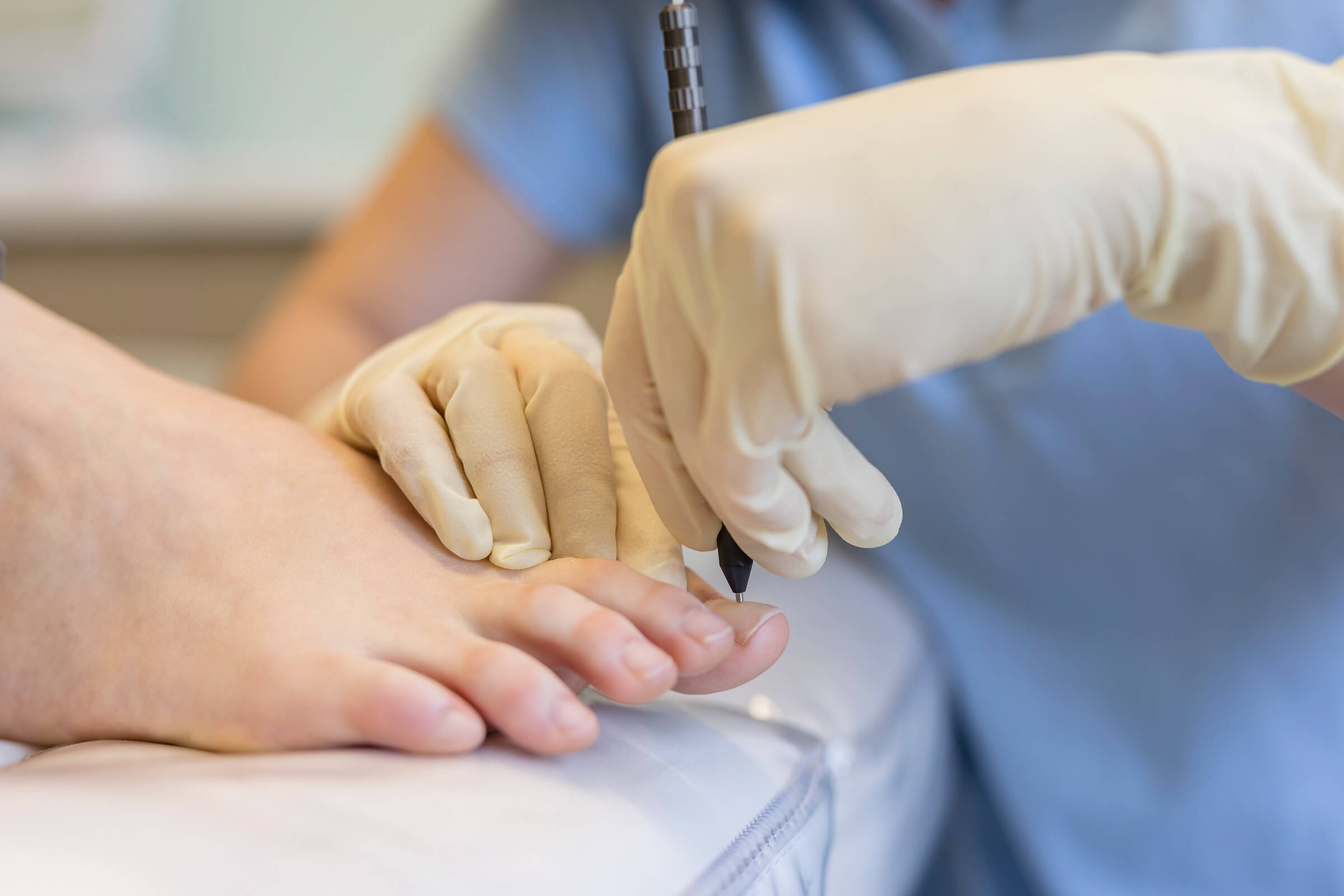 Med. Fußpflege Nagelbehandlung  - Hautarztpraxis Dr. Zorn in Kronberg 