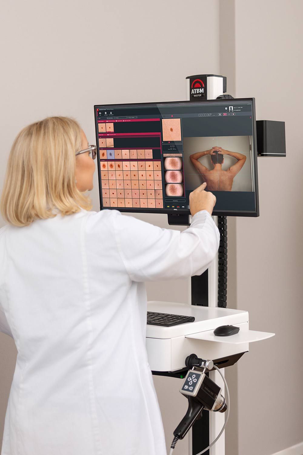 Laserscanningmikroskop Kontrolle Hautkrebs