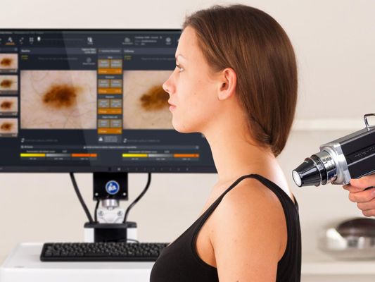 Hautkrebsvorsorge mit Foto-Video Dokumentation zur Verlaufskontrolle mit Fotofinder